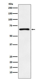 PTH1R Antibody in Western Blot (WB)