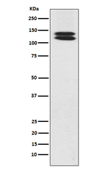 H-cadherin Recombinant Rabbit Monoclonal Antibody (K01_3W30)