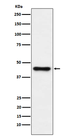 ABHD5 Recombinant Rabbit Monoclonal Antibody (K01_3W45)