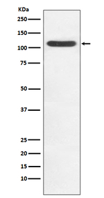 HIP1 Recombinant Rabbit Monoclonal Antibody (K01_3W50)