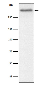 Versican Recombinant Rabbit Monoclonal Antibody (K01_3W55)