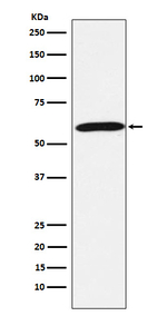 Calsequestrin Recombinant Rabbit Monoclonal Antibody (K01_3W68)