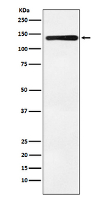 Bub1 Recombinant Rabbit Monoclonal Antibody (K01_3W71)