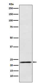 Prolactin Recombinant Rabbit Monoclonal Antibody (K01_3W78)