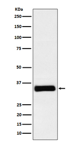 IGFBP2 Recombinant Rabbit Monoclonal Antibody (K01_3W79)