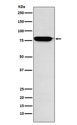 RANK Recombinant Rabbit Monoclonal Antibody (K01_3W85)