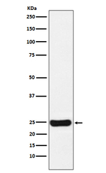 Cathepsin S Recombinant Rabbit Monoclonal Antibody (K01_3W87)