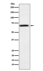 PMP70 Recombinant Rabbit Monoclonal Antibody (K01_3W91)