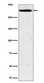MUC5B Recombinant Rabbit Monoclonal Antibody (K01_3W98)