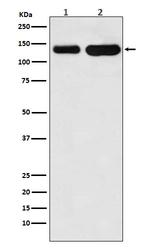 K-cadherin Recombinant Rabbit Monoclonal Antibody (K01_3X03)