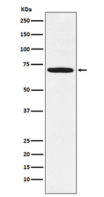 LIMK1 Recombinant Rabbit Monoclonal Antibody (K01_3X11)
