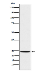 MAD2 Recombinant Rabbit Monoclonal Antibody (K01_3X13)
