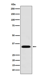 MBD3 Recombinant Rabbit Monoclonal Antibody (K01_3X14)