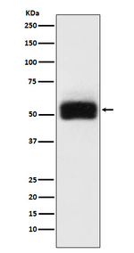 MMP17 Recombinant Rabbit Monoclonal Antibody (K01_3X23)