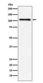 PRKD2 Recombinant Rabbit Monoclonal Antibody (K01_3X24)