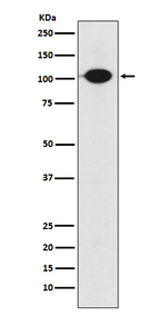 GABBR2 Recombinant Rabbit Monoclonal Antibody (K01_3X25)