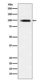 GIT1 Recombinant Rabbit Monoclonal Antibody (K01_3X29)