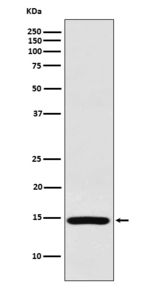 RPS19 Recombinant Rabbit Monoclonal Antibody (K01_3X32)