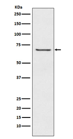 GABRB2 Recombinant Rabbit Monoclonal Antibody (K01_3X34)