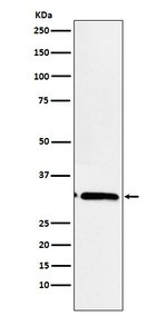 MAPRE3 Recombinant Rabbit Monoclonal Antibody (K01_3X41)