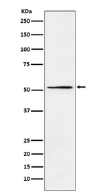 MEIS2 Recombinant Rabbit Monoclonal Antibody (K01_3X43)