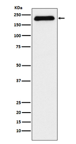 ATAD2 Recombinant Rabbit Monoclonal Antibody (K01_3X49)