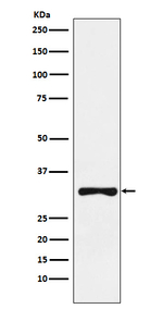 RYBP Recombinant Rabbit Monoclonal Antibody (K01_3X52)