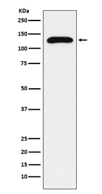 TRPC1 Recombinant Rabbit Monoclonal Antibody (K01_3X59)