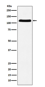 UBE1 Recombinant Rabbit Monoclonal Antibody (K01_3X60)