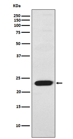 TNNI2 Recombinant Rabbit Monoclonal Antibody (K01_3X66)