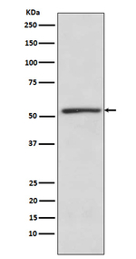 TBLR1 Recombinant Rabbit Monoclonal Antibody (K01_3X80)