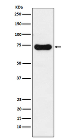 IRAK2 Recombinant Rabbit Monoclonal Antibody (K01_3X83)