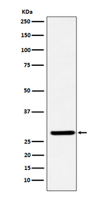 FHL2 Recombinant Rabbit Monoclonal Antibody (K01_3X87)
