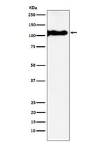 GRIK4 Recombinant Rabbit Monoclonal Antibody (K01_3X90)
