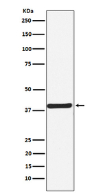 CaMKI Recombinant Rabbit Monoclonal Antibody (K01_3X96)