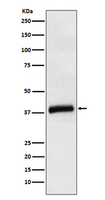 Apolipoprotein L1 Recombinant Rabbit Monoclonal Antibody (K01_3Y02)