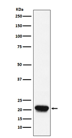 RHEB Recombinant Rabbit Monoclonal Antibody (K01_3Y03)