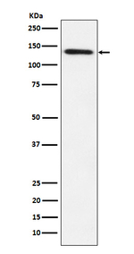 LPIN1 Recombinant Rabbit Monoclonal Antibody (K01_3Y11)