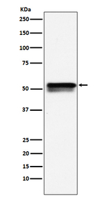 EGR2 Recombinant Rabbit Monoclonal Antibody (K01_3Y21)