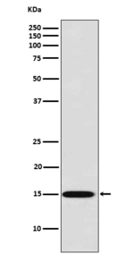 Galectin 7 Recombinant Rabbit Monoclonal Antibody (K01_3Y29)