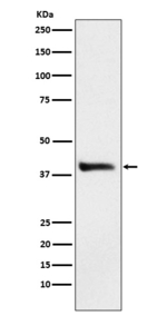 Alcohol Dehydrogenase 1A Antibody in Western Blot (WB)