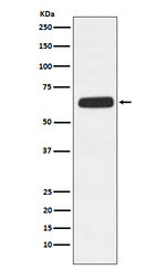 CD89 Recombinant Rabbit Monoclonal Antibody (K01_3Y35)