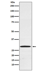 CDX1 Recombinant Rabbit Monoclonal Antibody (K01_3Y36)