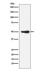 FOXL2 Recombinant Rabbit Monoclonal Antibody (K01_3Y38)