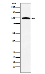TNPO3 Recombinant Rabbit Monoclonal Antibody (K01_3Y43)