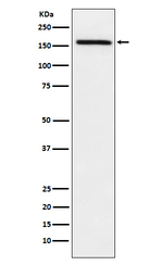 ADAMTS13 Antibody in Western Blot (WB)