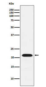 CBF beta Recombinant Rabbit Monoclonal Antibody (K01_3Y48)
