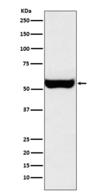 MAOB Recombinant Rabbit Monoclonal Antibody (K01_3Y57)