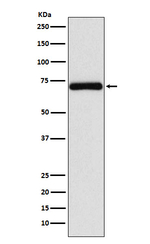 FZD8 Recombinant Rabbit Monoclonal Antibody (K01_3Y61)