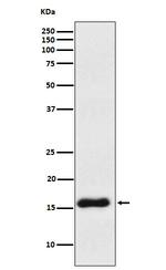 VAMP1 Recombinant Rabbit Monoclonal Antibody (K01_3Y62)